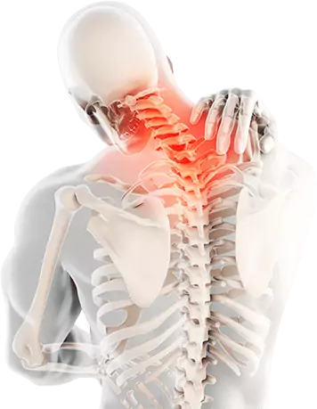 Columna vertebral con zona cervical inflamada — Flexosamine alivia el dolor articular cervical, de rodilla y lumbar desde las primeras 24 hrs
