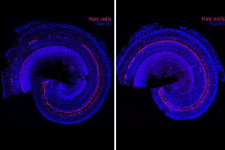 Microscopía de cóclea con células ciliadas (rojo) y núcleos (azul) — tejido objetivo de los nutrientes de Otomax para salud auditiva